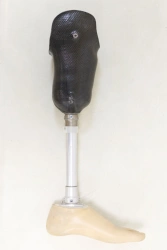 Modular tibial prosthesis, including congenital underdevelopment PN3-90