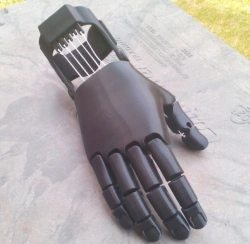 Active (traction) prosthesis of the hand, including for separation and partial separation of the hand