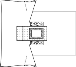 Sheet for limitation of the operating field (surgical covering) of the abdominal-promesenteric region, sterile