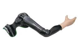 Prosthesis after shoulder dislocation with external energy source PR8-MBO