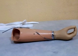 Active forearm prosthesis