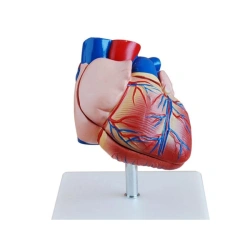 Enlarged Heart Model (3 parts), 56018