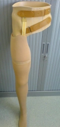 Hip replacement modular PN8-M hip replacement