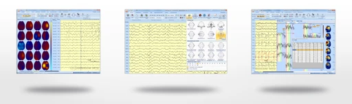 Multi-channel EEG Analyzer for Brain Activity Monitoring - Encephalan-131-03