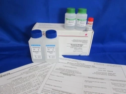 Reagent kit for enzymatic determination of urea concentration in serum, plasma and urine (kinetic UV method) (
