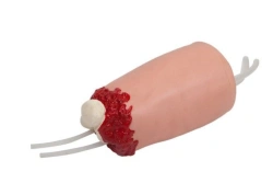 Hip model with amputation injury, H3008