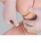 Baby simulator for enema placement S161