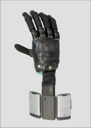 Hand prosthesis with external source of energy, including separation and partial separation of the hand PRO-30