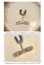 Endoprostheses of the auditory ossicles of the middle ear, ESC-"CONMET", partial according to TU 32.50.22-030-11458417-2021