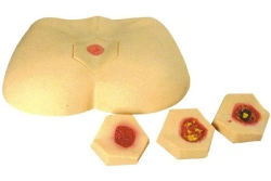 Bedsores Care Model Kit, 10B