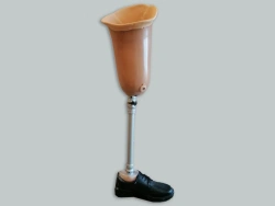Modular hip prosthesis, including for congenital underdevelopment