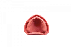 Gingiva for maxilla edentulous model with PD-DV BZ undercuts