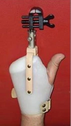 Working hand prosthesis, including partial and partial disarticulation of the hand PR0-P.1
