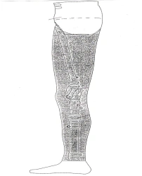 Modular prosthesis for hip dislocation
