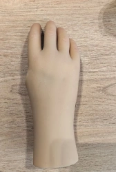 Cosmetic prosthesis of the hand, including partial and partial dislocation of the hand