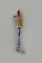 Modular hip prosthesis, including for congenital underdevelopment PH6-72.