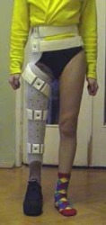 Knee and hip joint apparatus