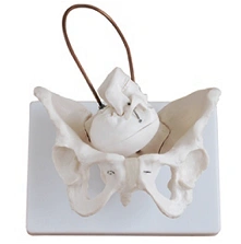 Bones of female pelvis and fetal skull, item SK1128-1