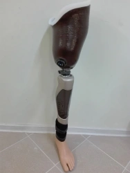 Modular hip prosthesis with microprocessor control