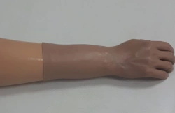 Cosmetic forearm prosthesis