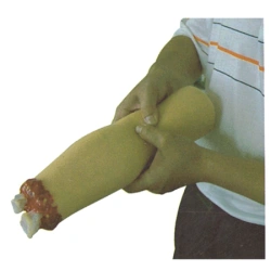 Hand model with amputation injury H2008 /FA6839