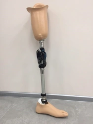 Modular hip prosthesis, including for congenital underdevelopment PN6-80-M