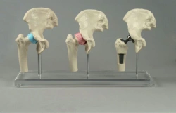 Set of hip models, 11205