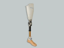 Modular prosthesis for hip dislocation