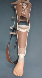 Non-modular tibial prosthesis, including congenital underdevelopment, PH3-H.1