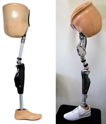 Modular microprocessor-controlled hip dislocation prosthesis