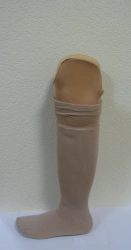 Modular tibial prosthesis, including those with underdevelopment
