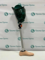 8-07-10 Modular hip prosthesis, including for congenital underdevelopment.