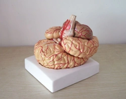 Model of a brain with vessels (6 parts), art. 18220-2