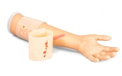 Hand phantom with forearm for treatment of burns and wounds, suturing and removal of sutures ZIK-18