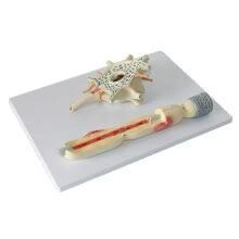 Enlarged model of brain neuron, 18001