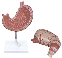 Anatomical model of stomach, item 12002-1