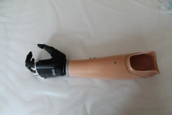 Forearm prosthesis with microprocessor control PR2-WIE