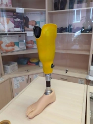 Modular tibia prosthesis, including underdevelopment PN3-87