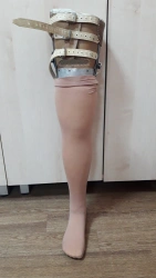 Non-modular hip prosthesis, including congenital underdevelopment, PH6-H.1