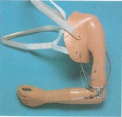 Prosthesis after shoulder dislocation with electromechanical actuator and contact control system PR8-VK-OC