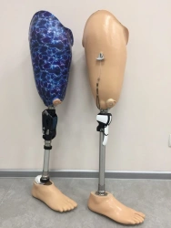 8-07-10 Modular hip prosthesis, including for congenital underdevelopment.