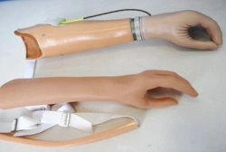 Active (traction) forearm prosthesis