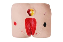 Bedsores Care Model Kit, NS6026