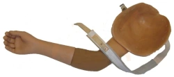 Prosthesis after shoulder dislocation functional-cosmetic