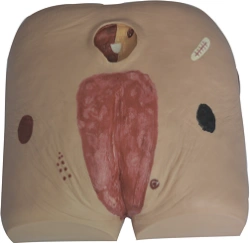 Model for pressure sores care, 10