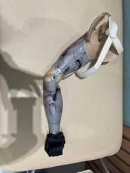 Working shoulder prosthesis