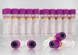 Vacuum tubes "Acti-Fine®" for venous blood sampling with K2EDTA, gel, size 13x100 mm, volume: 4,0 ml.