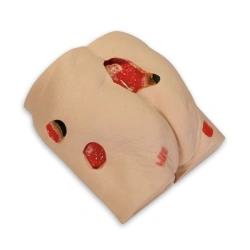 Bedsores phantom