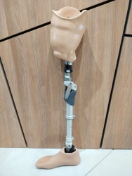 Modular hip prosthesis, including those with underdevelopment