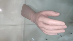 Cosmetic prosthesis of the hand, including partial and partial dislocation of the hand